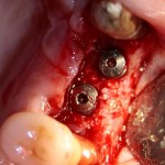 0_e916c_86214ab8_L[1]