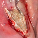 Не существует "волшебных биоматериалов". Игнорирование принципа "omnis cellula e cellula" приводит к закономерным результатам.