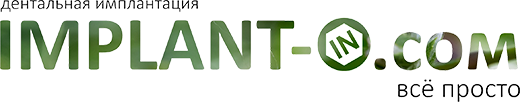 IMPLANT-IN.COM — дентальная имплантация. естественно.